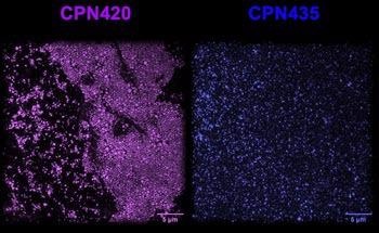 Iron Oxide Incorporated Conjugated Polymer Nanoparticles (CPNs)