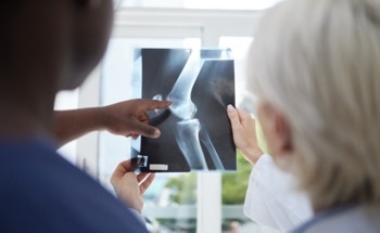 New 3D-Printable Bioactive Glass for Bone Repair