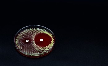 Multifunctional Nanogels: A Breakthrough in Antibacterial Strategies