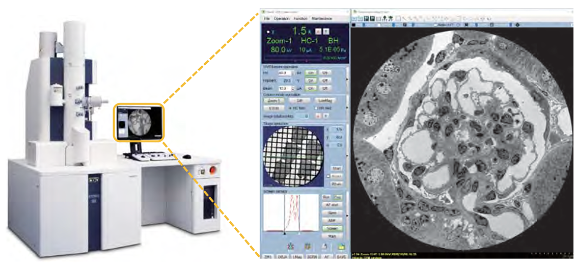 HT7800: A Fully Digital, Versatile Transmission Electron Microscope