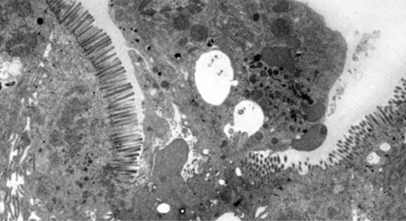 Rat jejunum (unstained), accelerating voltage 80 kV, magnification x2,000.
