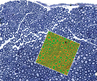 Stained peripheral nerve tissue from Mus musculus. DirectTiling of optical images superimposed with QI scan using DirectOverlay.
